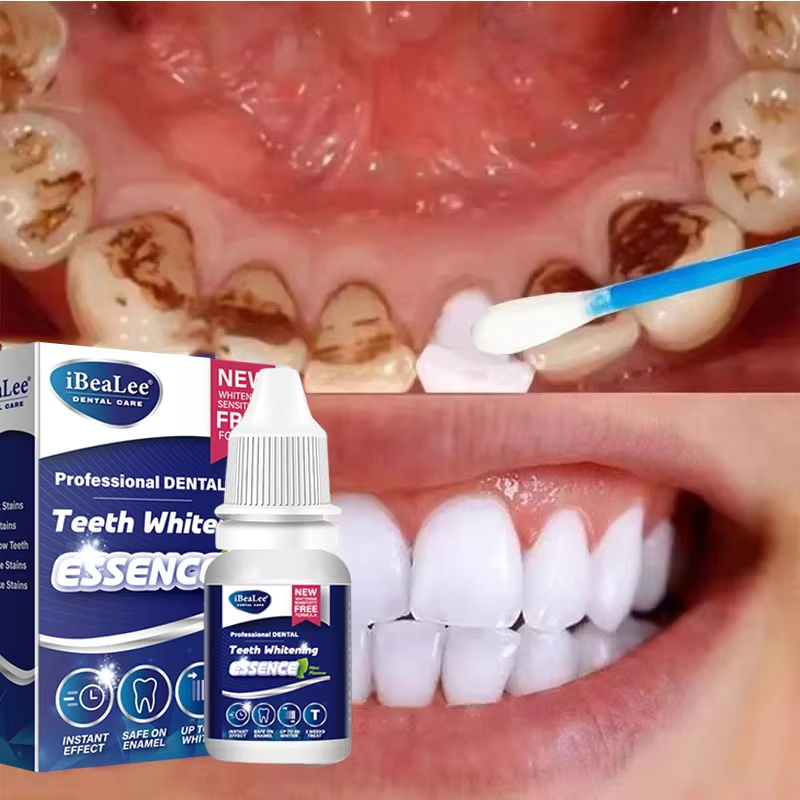 Teeth Whitening Serum - Essenza sbiancante per denti, rimuove le