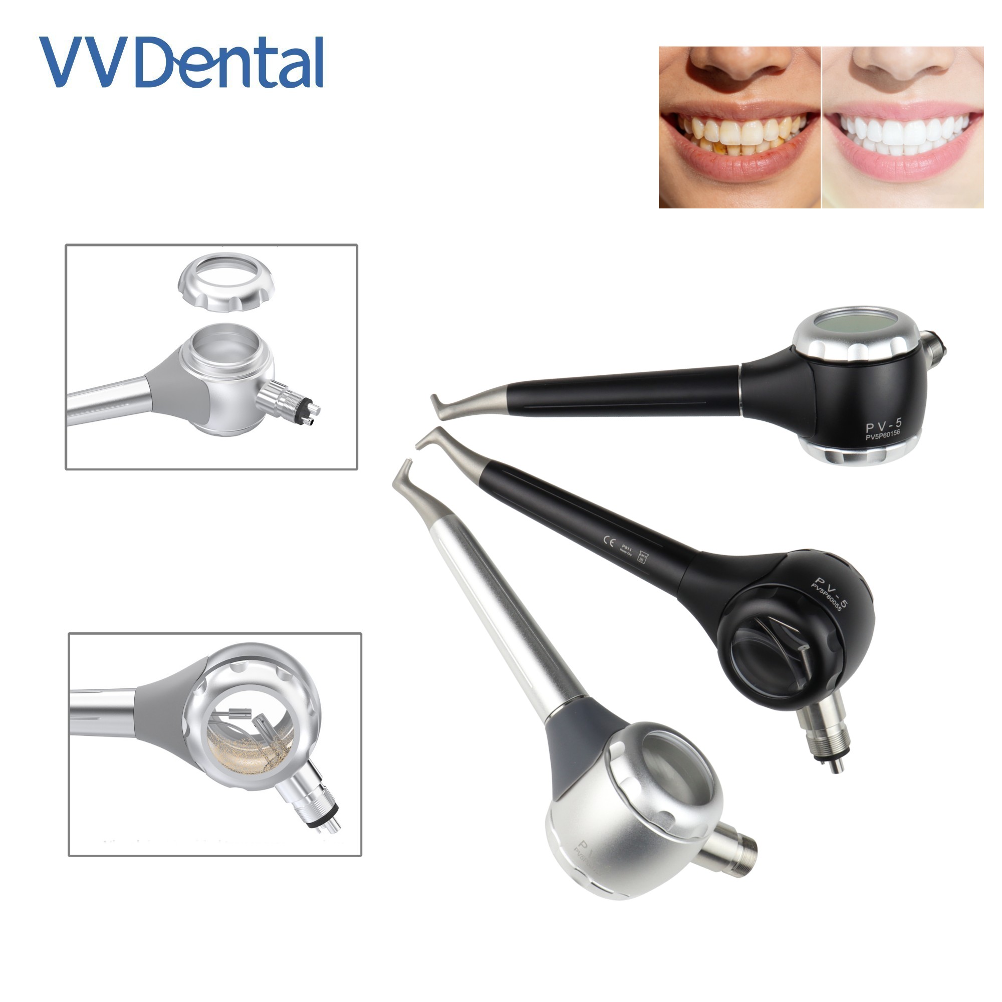 Teeth Whitening China - Pistola per Sabbiatura Dentale VV a