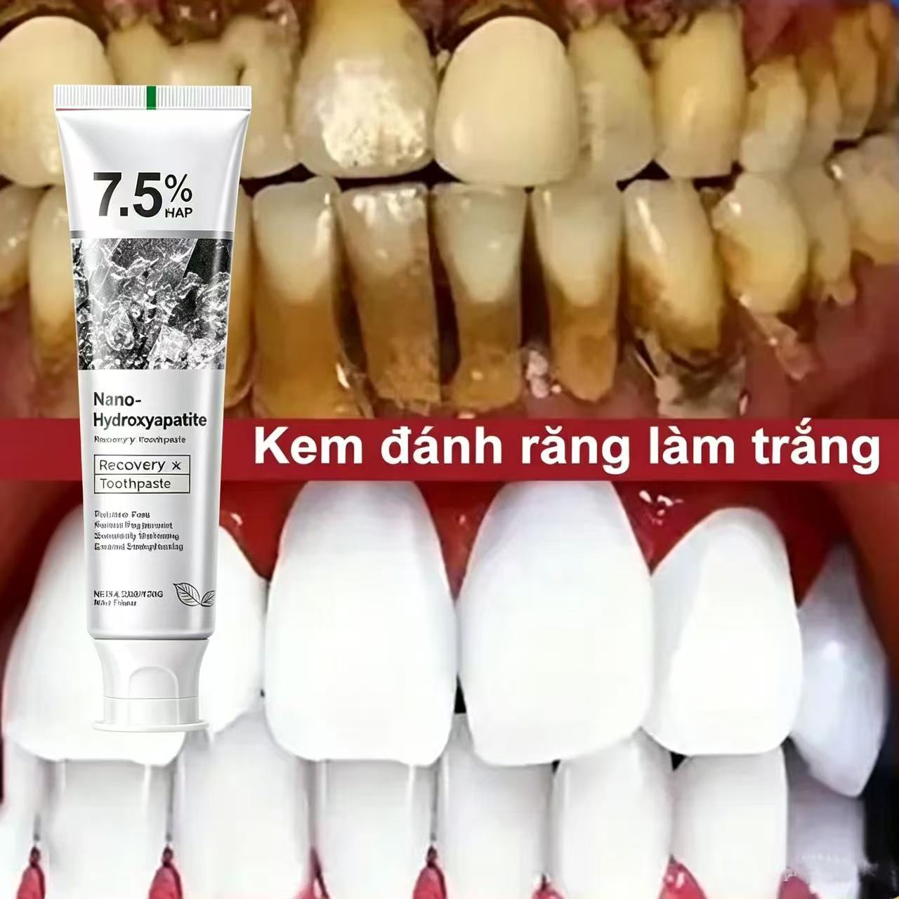 Hydroxyapatite Toothpaste - Dentifricio Sbiancante Probiotico con 7,5% di