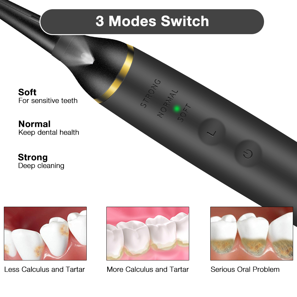 Elettrico Sonic Dental Calculu - Teeth Whitening Led Kit recensione e prezzo