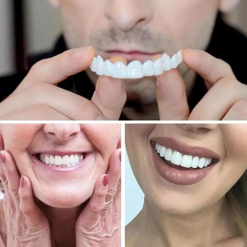 Nuove faccette dentali sbianca - Teeth Whitening With Braces recensione e prezzo