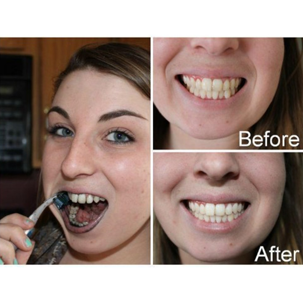 Denti di carbone di bambù dent - Teeth Whitening From Home recensione e prezzo