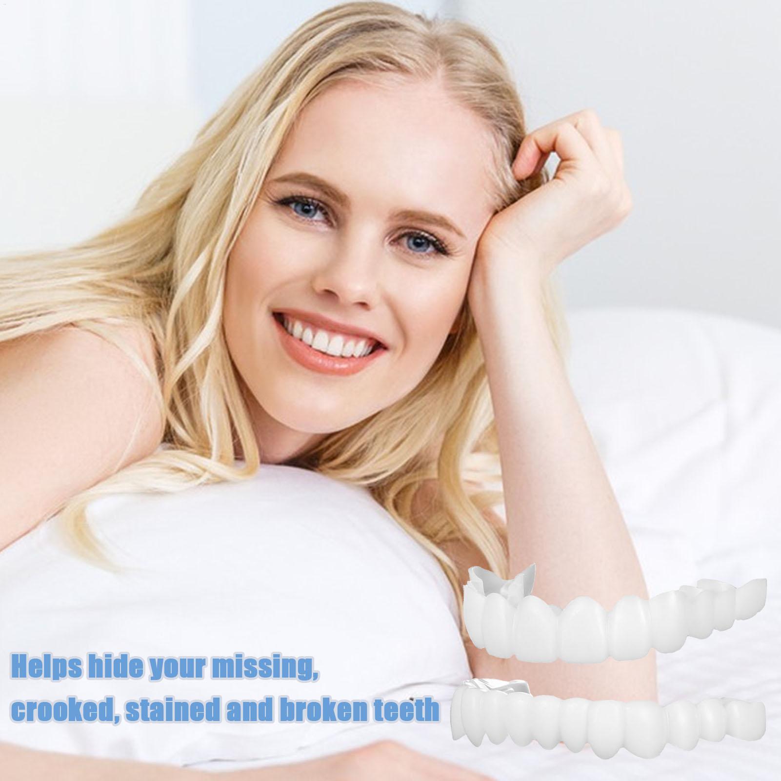 Copertura Dentale Superiore e  - Teeth Whitening With Braces recensione e prezzo