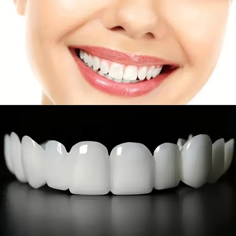 Nuove Faccette Dentali Cosmeti - Teeth Whitening With Braces recensione e prezzo