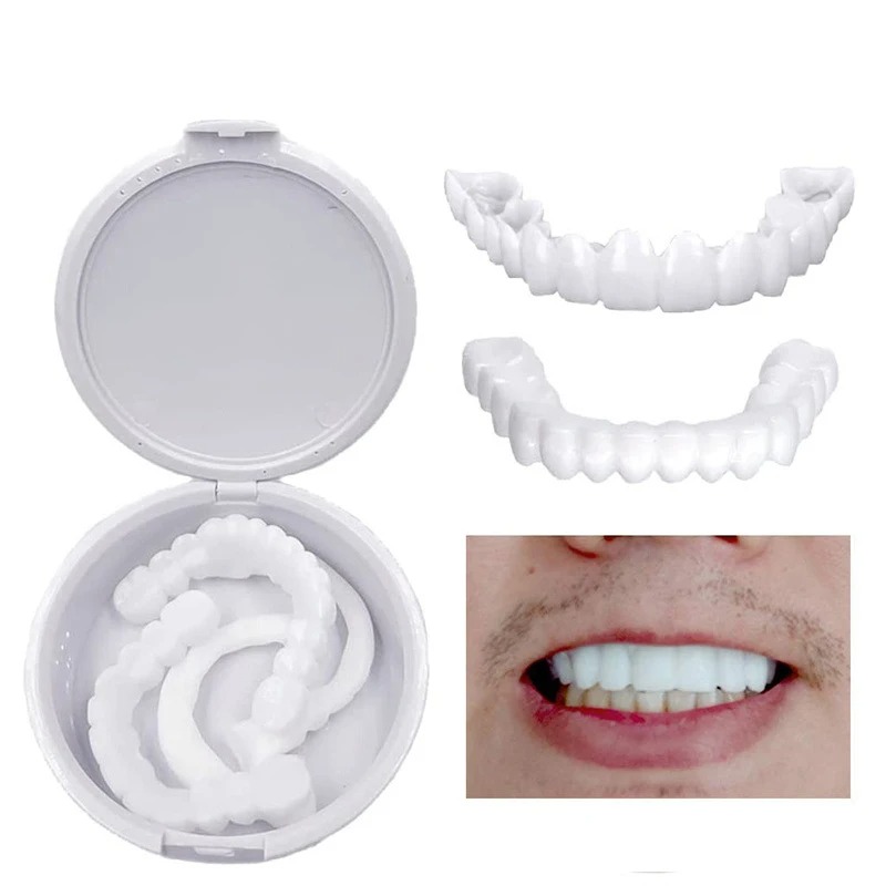 Faccette Dentali Sbiancanti Is - Teeth Whitening With Braces recensione e prezzo