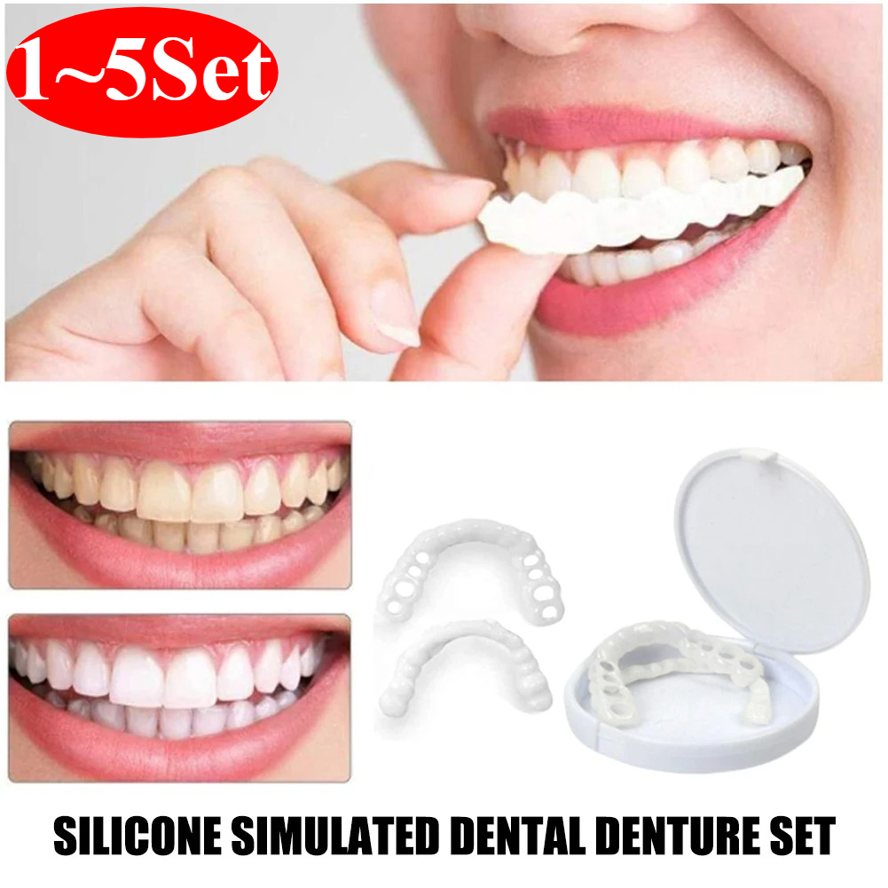 Copertura Pop ite per Sbiancam - Teeth Whitening With Braces recensione e prezzo