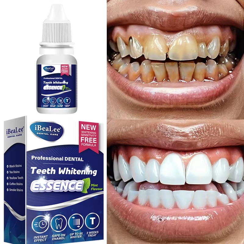 Essenza sbiancante per denti,  - Teeth Whitening Serum recensione e prezzo