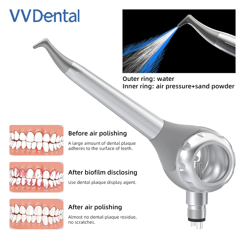Pistola per Sabbiatura Dentale - Teeth Whitening China recensione e prezzo