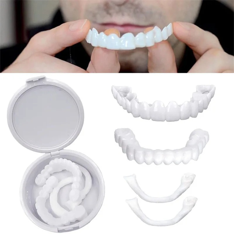 Nuove Faccette Dentali Sbianca - Teeth Whitening With Braces recensione e prezzo