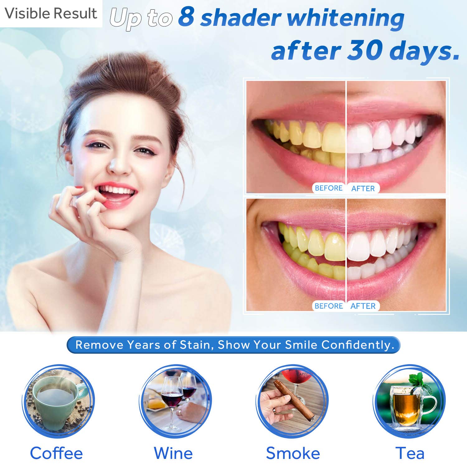 Gel sbiancante per denti Ricar - Teeth Whitening From Home recensione e prezzo
