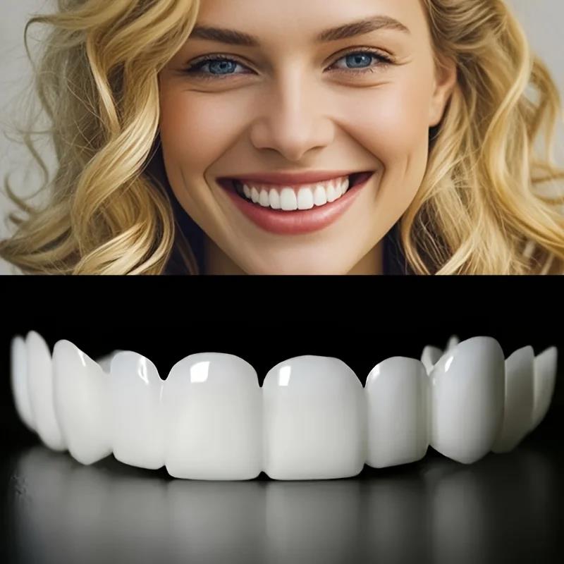 Nuove Faccette Dentali Sbianca - Teeth Whitening With Braces recensione e prezzo