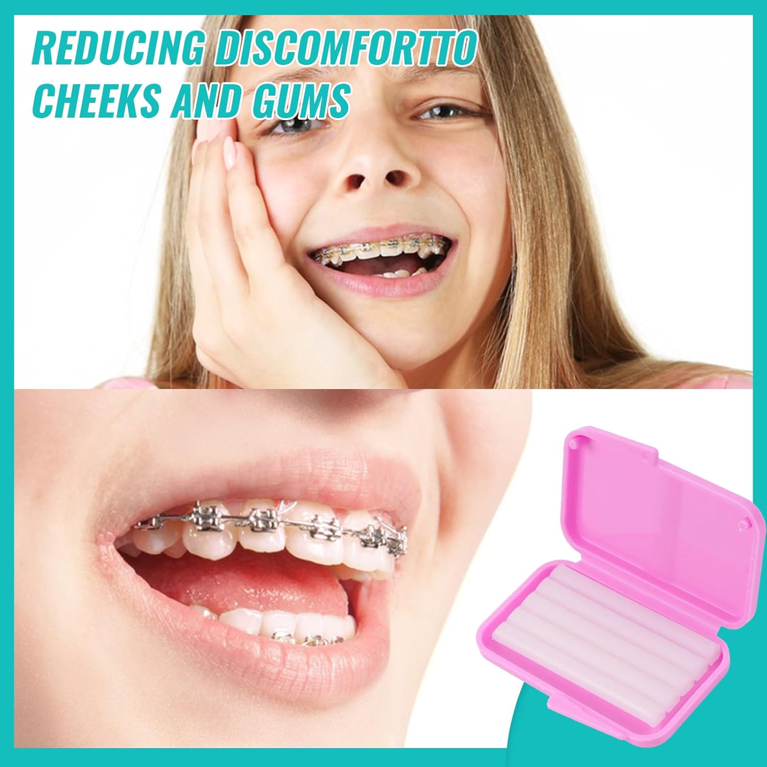 10 scatole Dentale Ortodontico - Teeth Whitening With Braces recensione e prezzo