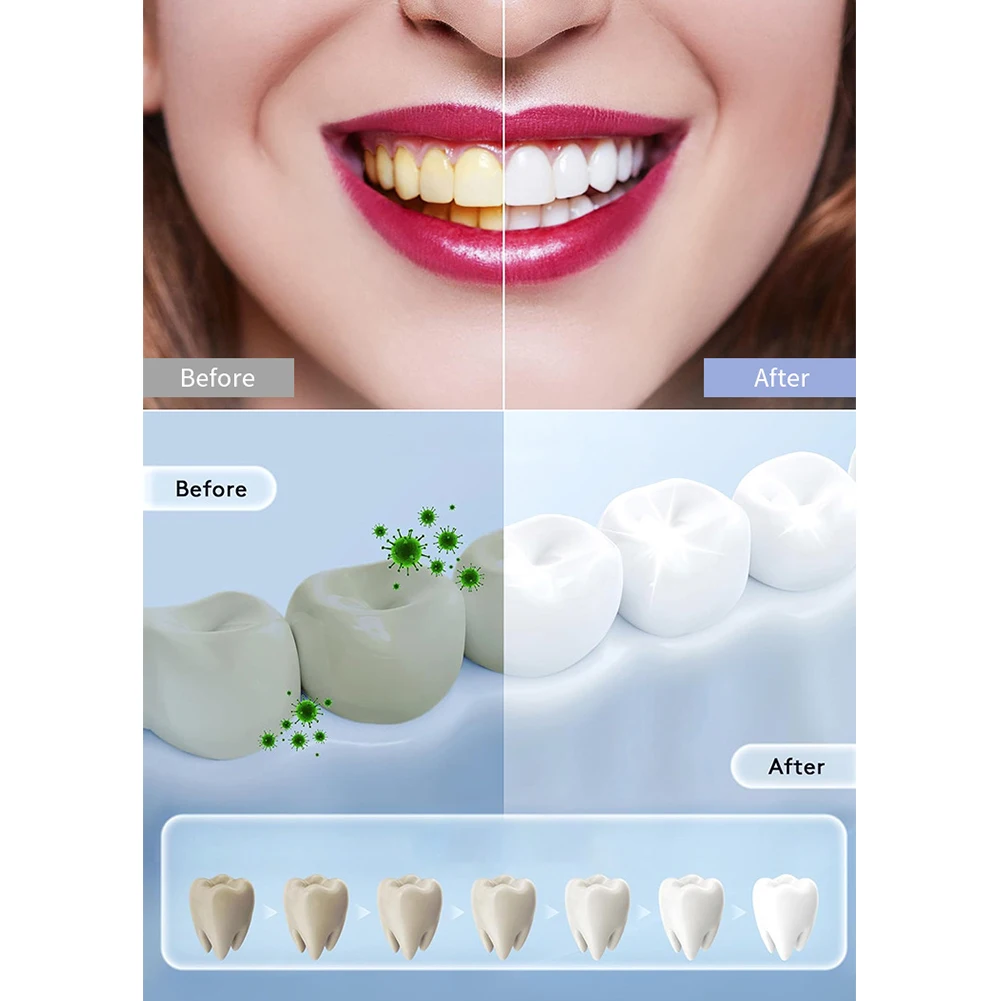 1PC Lampada per sbiancamento d - Teeth Whitening Uv recensione e prezzo