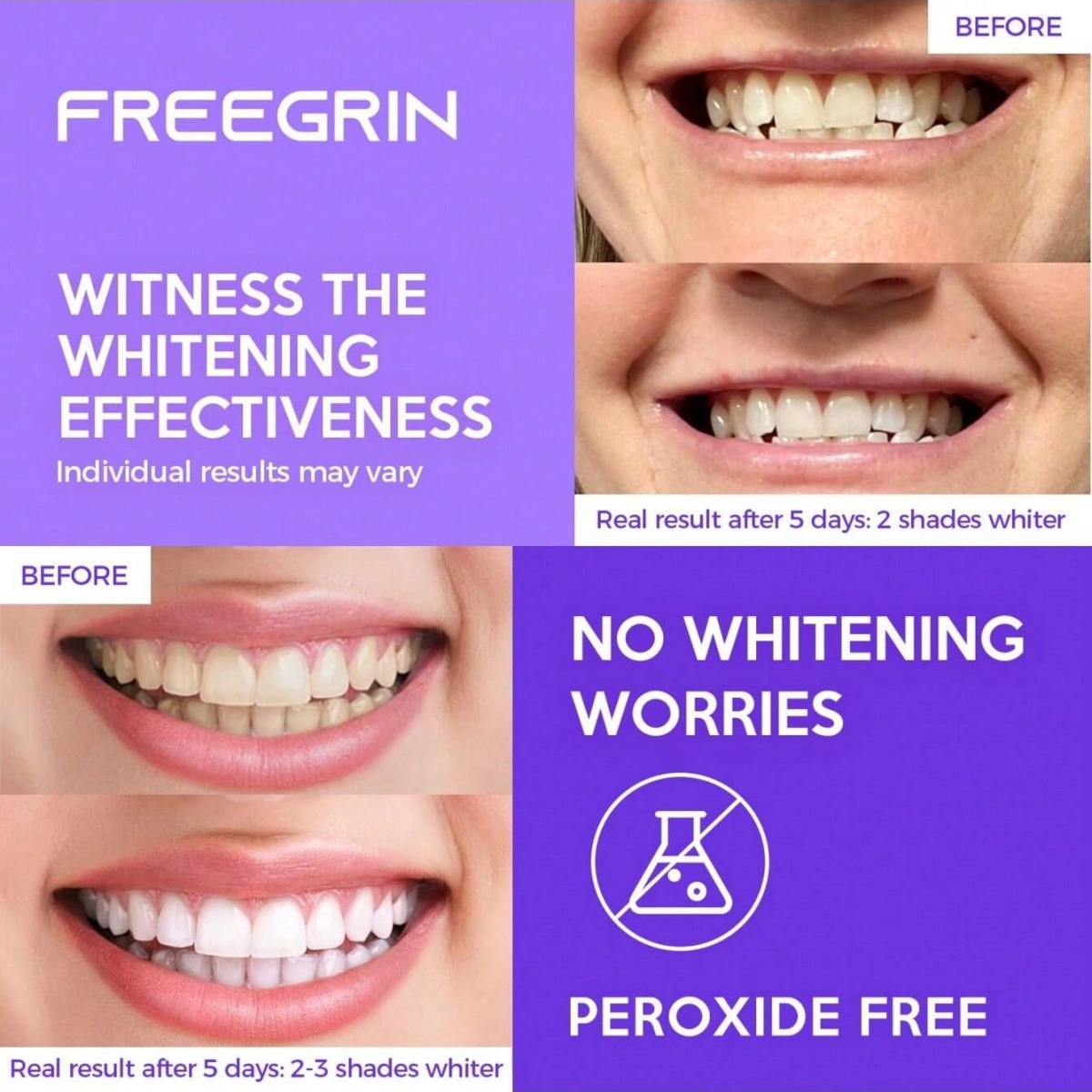Adesivi sbiancanti per denti d - Teeth Whitening From Home recensione e prezzo