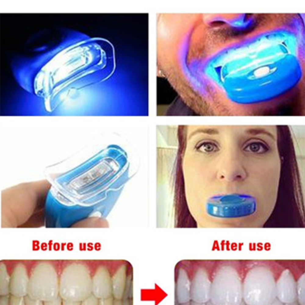 Nuovo Led blu sbiancamento dei - Teeth Whitening Uv recensione e prezzo