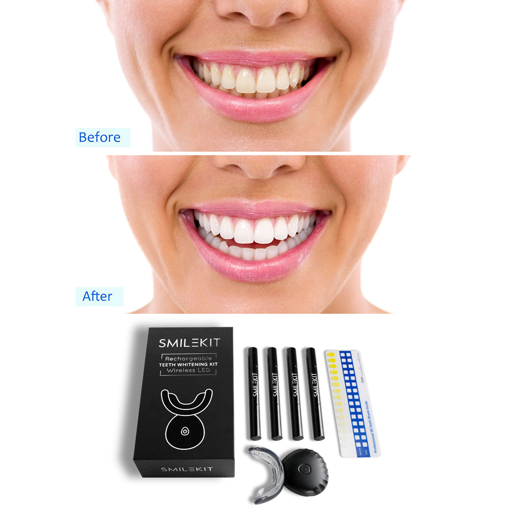 Nuovi kit di gel per sbiancame - Teeth Whitening Led Kit recensione e prezzo