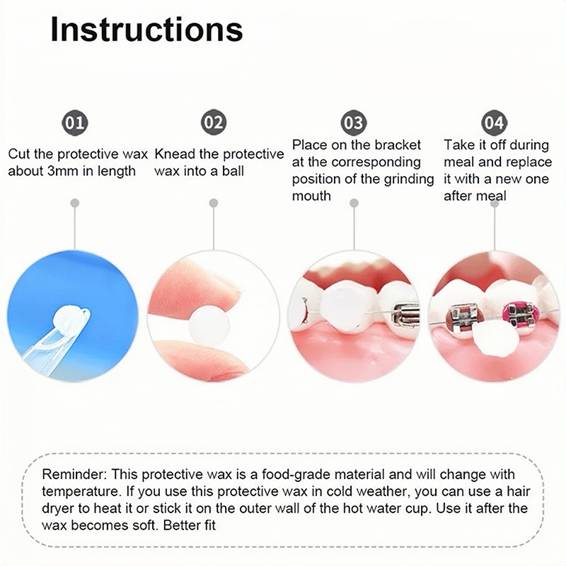 10 pz Dentale Ortodontico Soll - Teeth Whitening With Braces recensione e prezzo