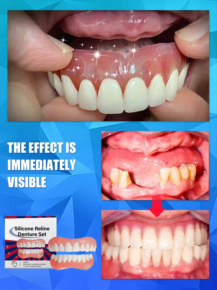 Denti finti Impiallacciature s - Teeth Whitening With Braces recensione e prezzo