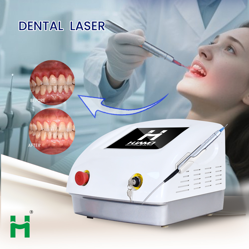 Kit Portatile per Sbiancamento - Teeth Whitening Led Kit recensione e prezzo