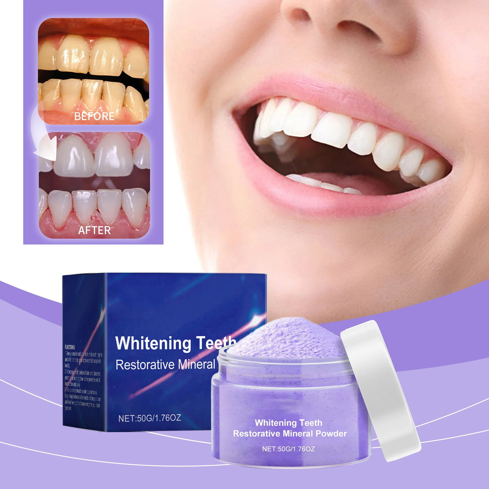 Kit Sbiancante Denti 2ª Genera - Teeth Whitening Serum recensione e prezzo