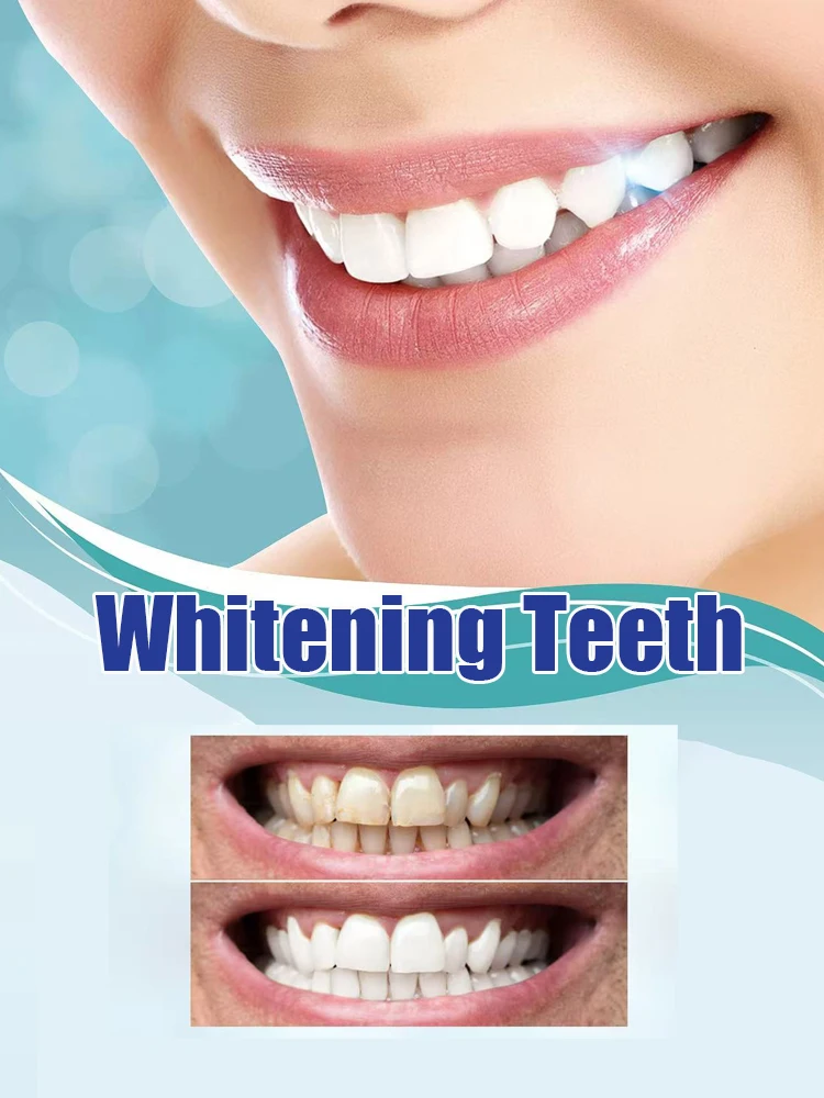 Kit Sbiancante Denti 2ª Genera - Teeth Whitening Serum recensione e prezzo