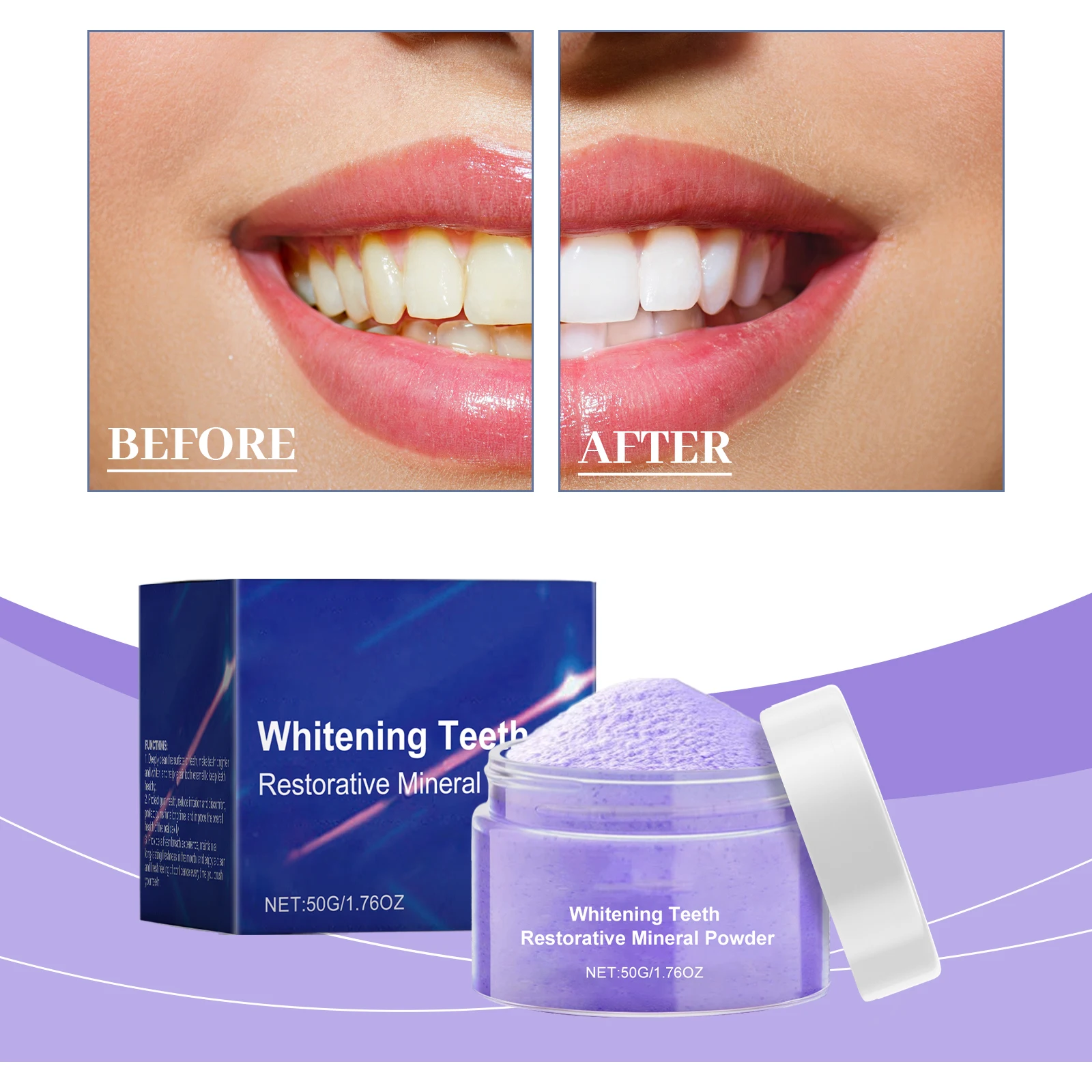 Kit Sbiancante Denti 2ª Genera - Teeth Whitening Serum recensione e prezzo