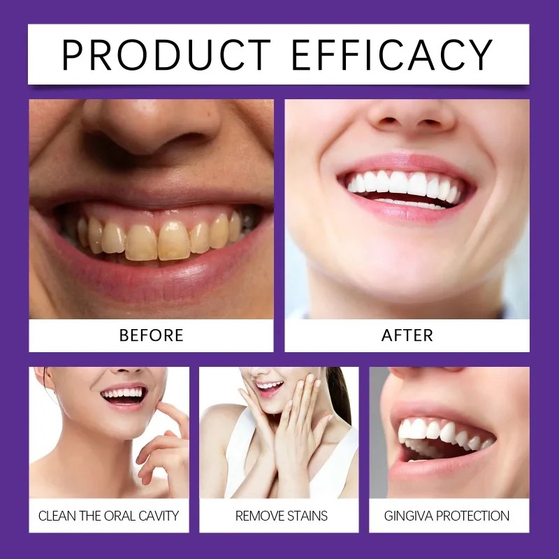 Polvere Minerale Viola per il  - Teeth Whitening China recensione e prezzo