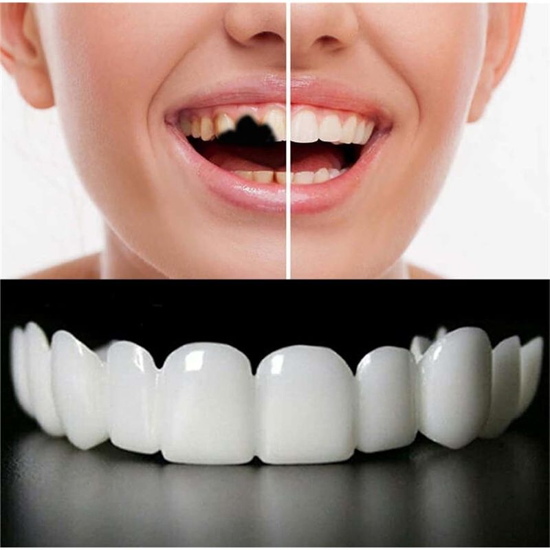 [NUOVO! ABMK] 2 Paia, Ripristi - Teeth Whitening With Braces recensione e prezzo