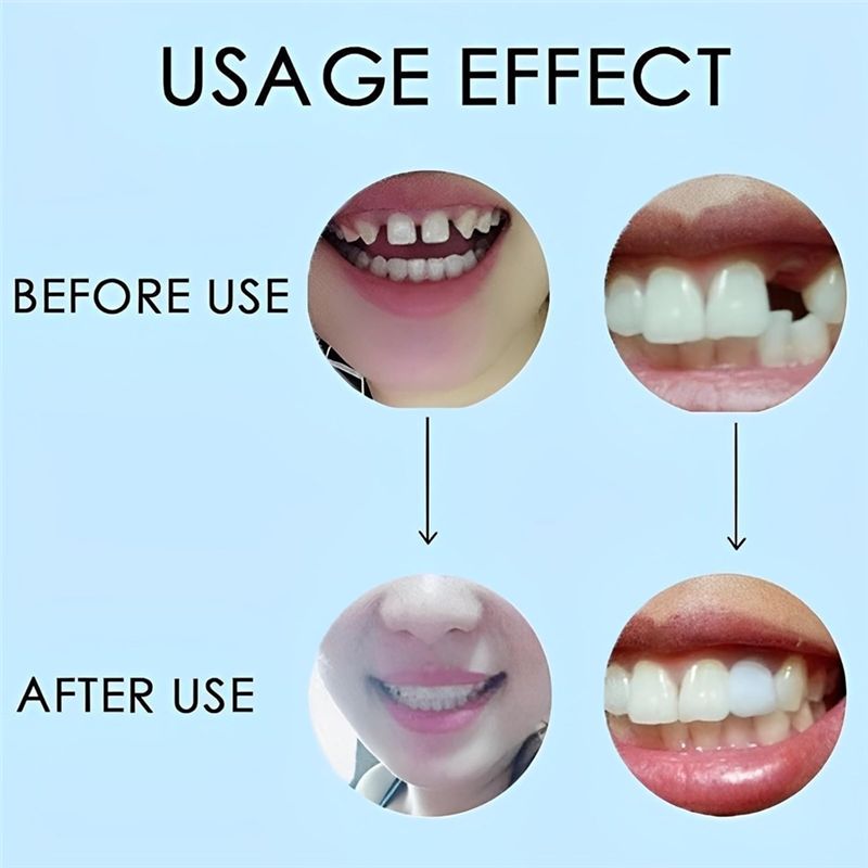 [NUOVO! ABMK] 2 Paia, Ripristi - Teeth Whitening With Braces recensione e prezzo