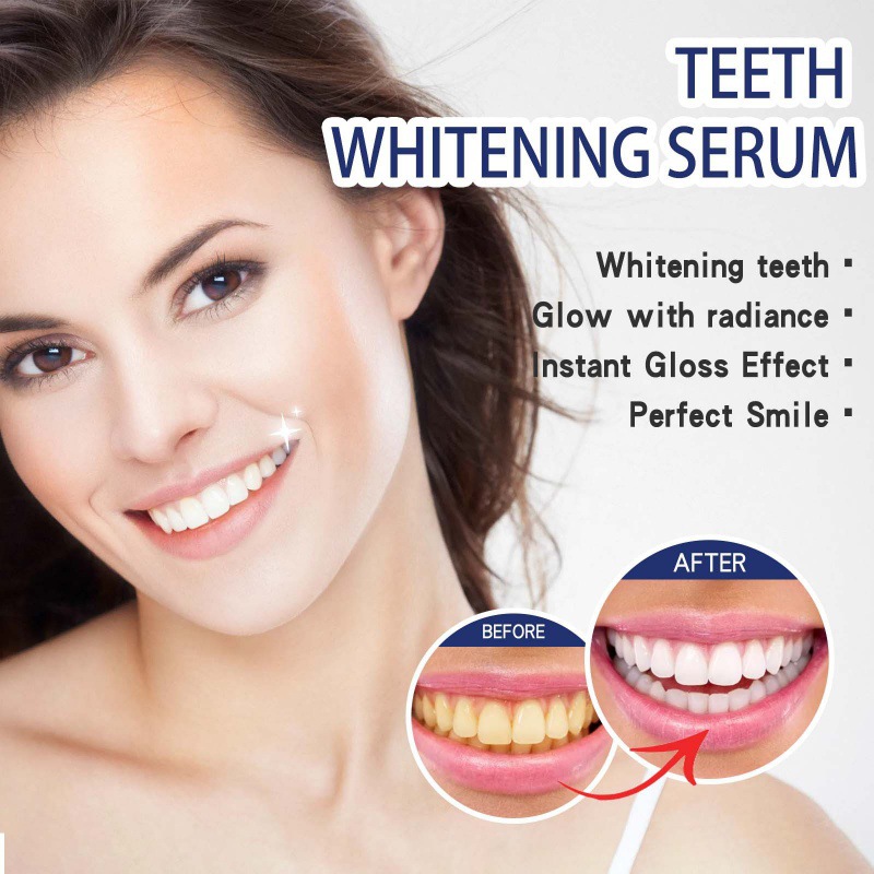 Siero sbiancante professionale - Teeth Whitening Serum recensione e prezzo