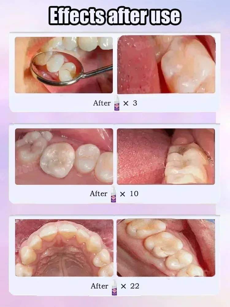 Dentifricio per la pulizia dei - Teeth Whitening Uv recensione e prezzo
